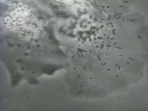 Биология. Учебные фильмы по биологии. Риккетсии