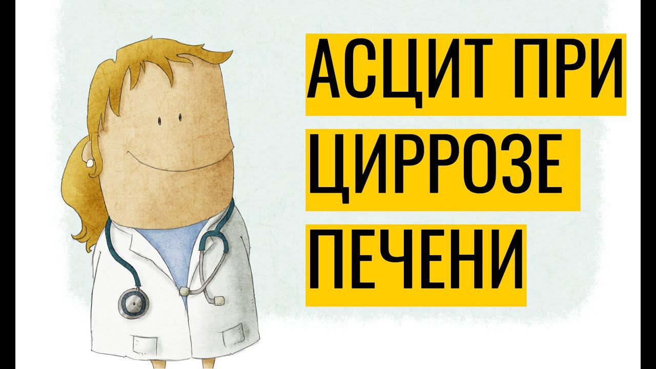 Асцит при циррозе печени: почему возникает и как лечить