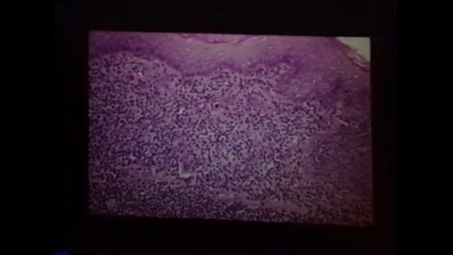 Diseases Of Hamsters Dr Bunte 1994 смотреть онлайн