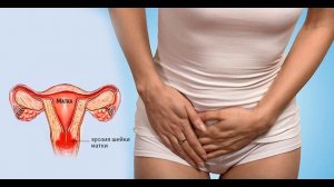 Тампоны с луком