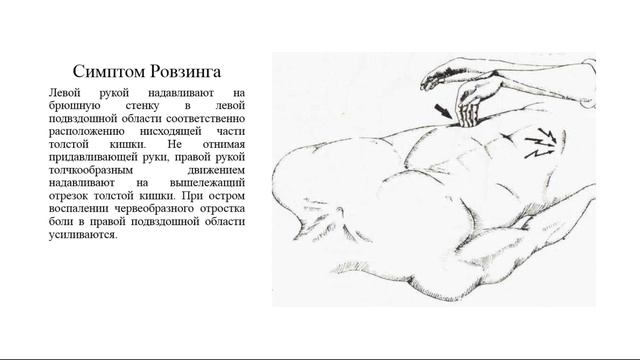 Острый аппендицит смотреть онлайн