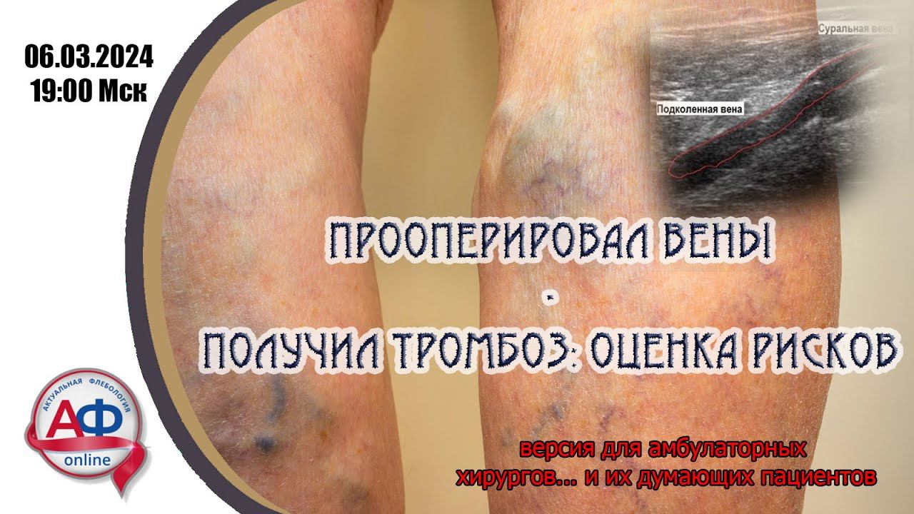 Прооперировал вены - получил тромбоз: оценка рисков. Эфир для амбулаторных хирургов и пациентов смотреть онлайн