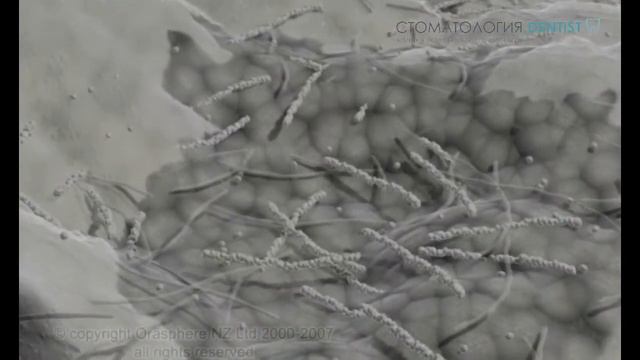 Рабердам, что это и для чего он нужен при лечении зуба смотреть онлайн