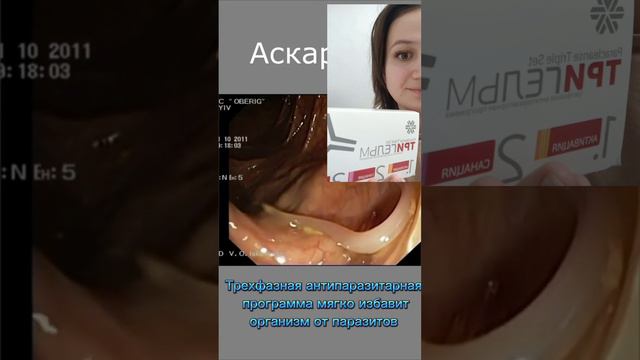 🪱ПАРАЗИТЫ ВНУТРИ ЧЕЛОВЕКА🥵АСКАРИДЫ😱АНТИПАРАЗИТАРНАЯ ПРОГРАММА🔥🔥🔥 смотреть онлайн