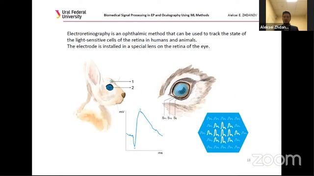 BIOMEDICAL SIGNALS PROCESSING IN ELECTROPHYSIOLOGY AND OCCULOGRAPHY USING MACHINE LEARNING METHODS смотреть онлайн