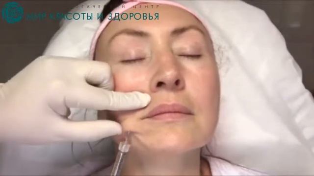 Корекция носогубных складок филлерами в Мир Красоты и Здоровья смотреть онлайн