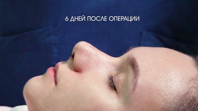 Кончик носа смотреть онлайн