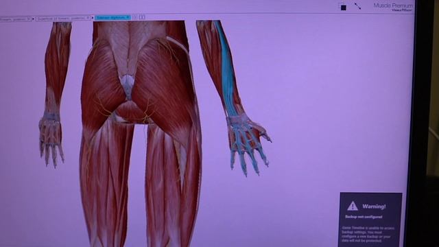 Fix Tennis Elbow in One Week - Exercises that Actually Work! смотреть онлайн