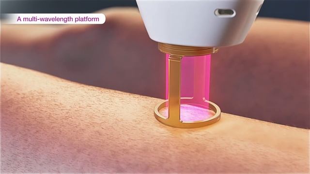 Laser hair removal - GentleMax Pro Plus (3D medical device animation) смотреть онлайн