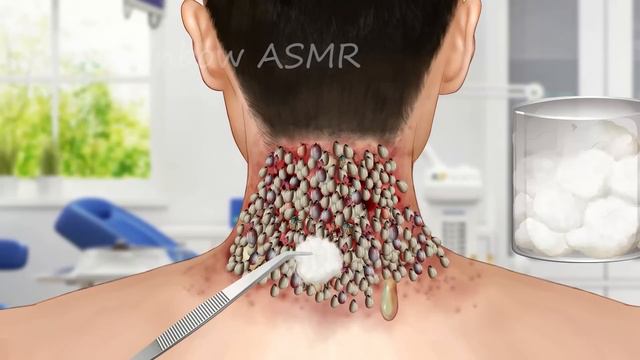 ASMR Dirty Face & Maggot & Worm Removal | Deep Cleaning Animation смотреть онлайн