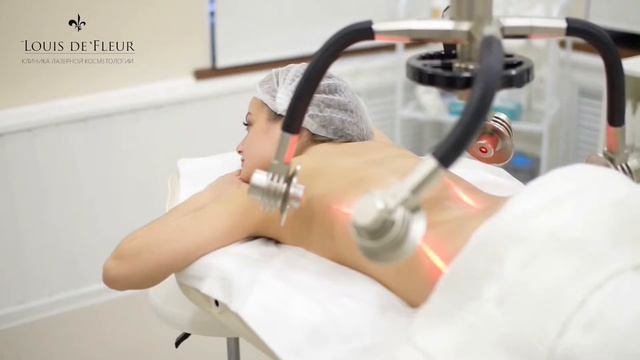 Лазер Zerona в клинике Louis De Fleur