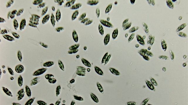 Scenedesmus ecornis - стадии развития смотреть онлайн