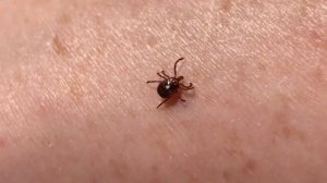 Осторожно клещи! Как бороться с укусами клещей