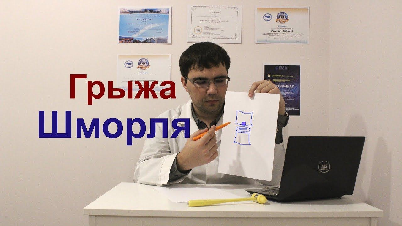 Грыжа Шморля: причины, симптомы, лечение смотреть онлайн