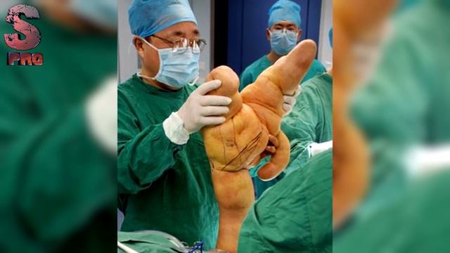 8 АНОМАЛЬНЫХ ЛЮДЕЙ С ГЕНЕТИЧЕСКИМИ ОТКЛОНЕНИЯМИ смотреть онлайн