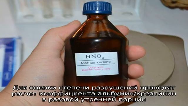 Что такое альбуминурия смотреть онлайн