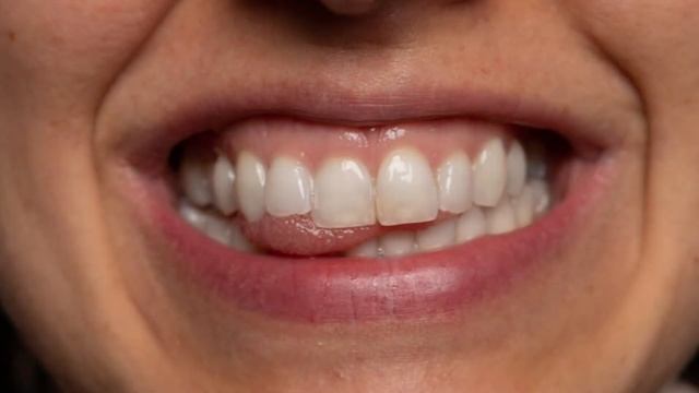 Милк огриги даволаш шамоллаши давоси