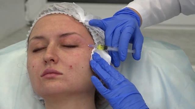 Мезотерапия век