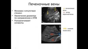 основы ультразвуковой анатомии печени. Профессор  В. Изранов