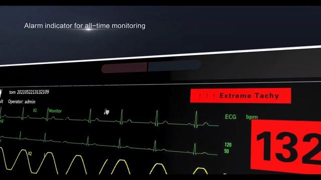 Lepu Remote Monitoring Devices AI Multiparameter Patient Monitor Vital Signs Monitor With Trolley смотреть онлайн