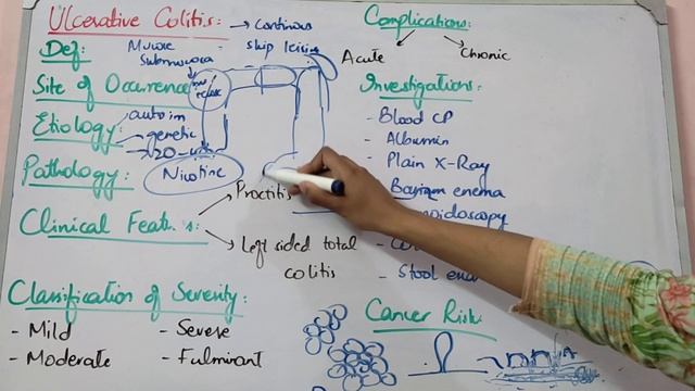 GIT SURGERY lecture 45 ULCERATIVE COLITIS very important features with scenario made easy смотреть онлайн