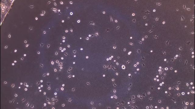 Living biointerfaces based on non-pathogenic bacteria support stem cell differentiation смотреть онлайн