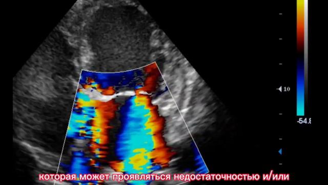 Митральная недостаточность у собак и кошек | Причины смотреть онлайн