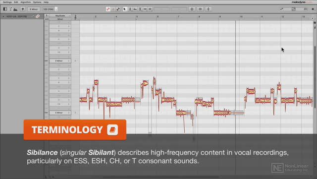 16. Sibilant Detection & Sibilant Balance Tool