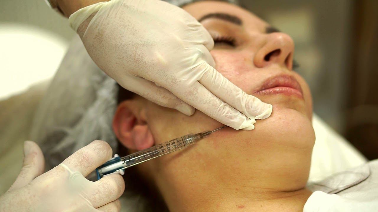 Контурная пластика: коррекция подбородка. смотреть онлайн