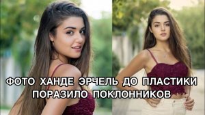 ФОТО ХАНДЕ ЭРЧЕЛЬ ДО ПЛАСТИКИ ПОРАЗИЛО ПОКЛОННИКОВ. Ханде Эрчел. Hande Erçel. Турецкие актёры .