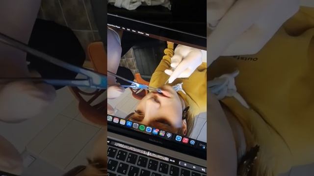 прокол губы, новое видео вышло! смотреть онлайн