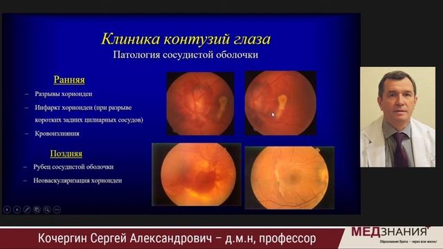 Современные аспекты диагностики и лечения механических травм глаза смотреть онлайн