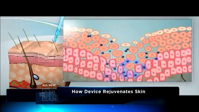 Jet Peel Medical Course смотреть онлайн
