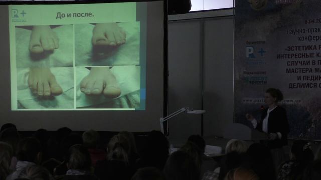 Все о дефектах ногтевой пластины. Деформированные и вросшие ногти. смотреть онлайн