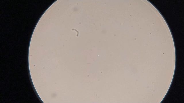 Моча под микроскопом смотреть онлайн