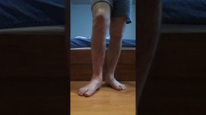 Перелом пятки