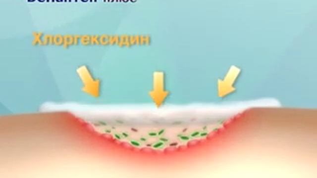 Бепантен® Плюс