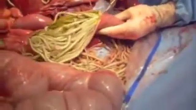 МІЛЬЯРДИ АСКАРИД В КИШКАХ КОНЯmp4 смотреть онлайн