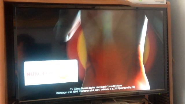 Nurofen 2019 Ad смотреть онлайн