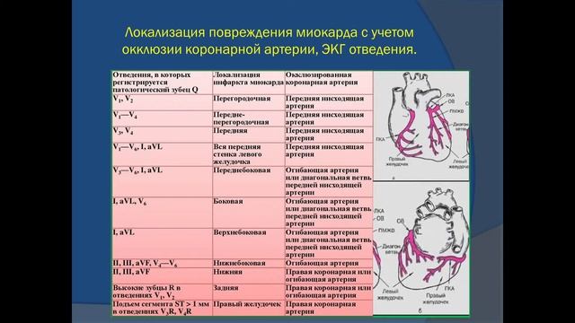 Степанец Е.А. Острый коронарный синдром. Инфаркт миокарда смотреть онлайн