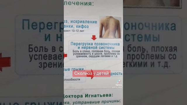 Лечение сколиоза у детей-доктор Радион.￼ смотреть онлайн