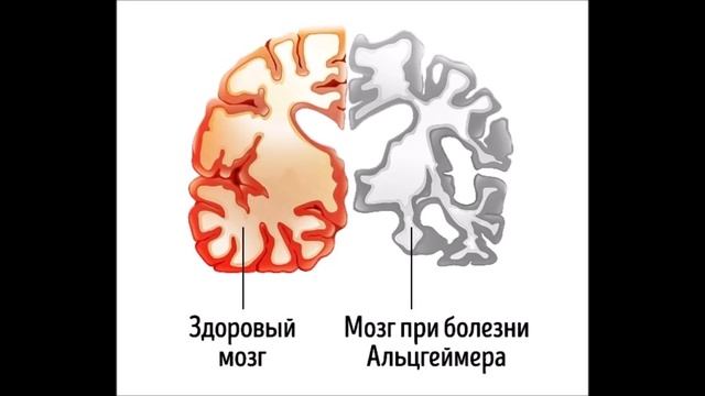 DEAF Питахайя полезные свойства смотреть онлайн