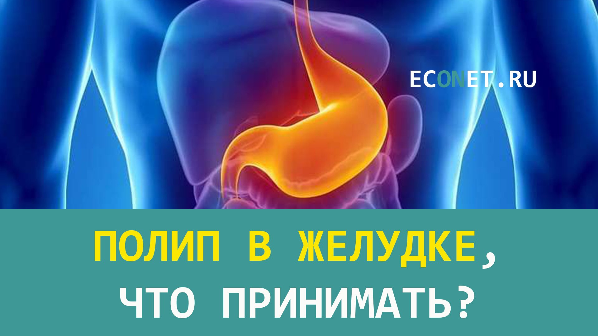 Полип в желудке, что принимать