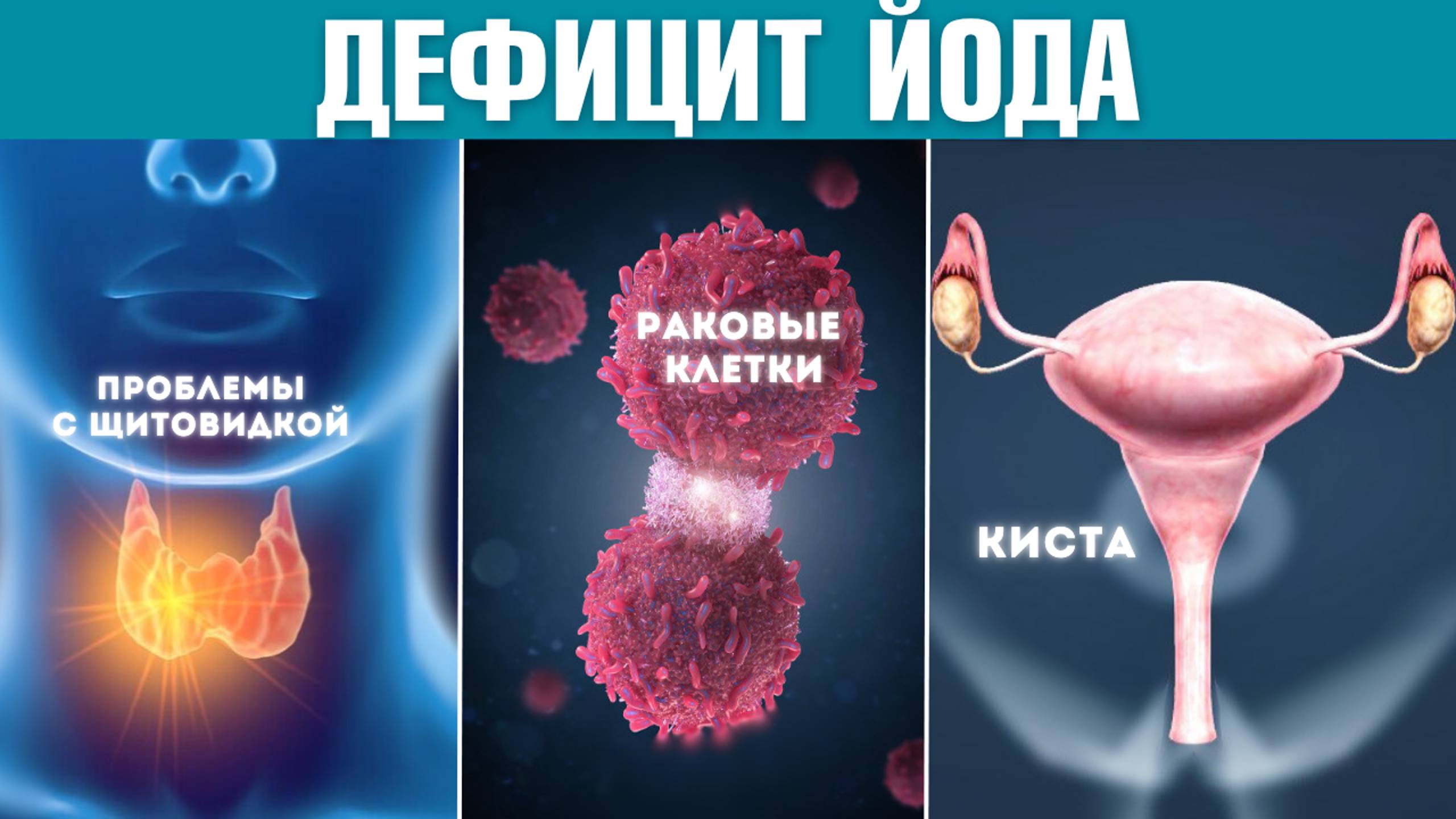 Вот что будет, если у вас нехватка ЙОДА! Чем полезен йод для организма и как он предотвращает РАК? смотреть онлайн