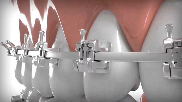 Waterpik® Oral Health - Hygiene смотреть онлайн