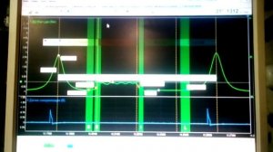 Надо ли глушить клапан ЕГР .форд фокус 2 и клапан EGR