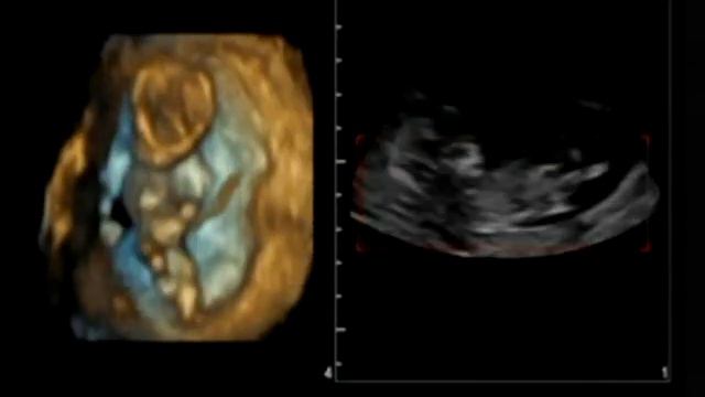 Introducing Munchkin... смотреть онлайн