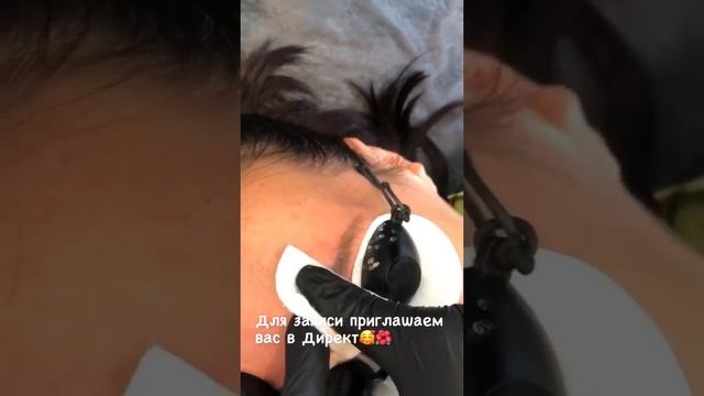 Лазерное удаления татуажа бровей смотреть онлайн