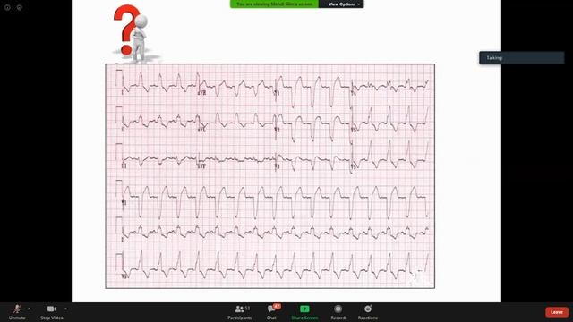 Visioconf - Cardio : Troubles de conduction . смотреть онлайн