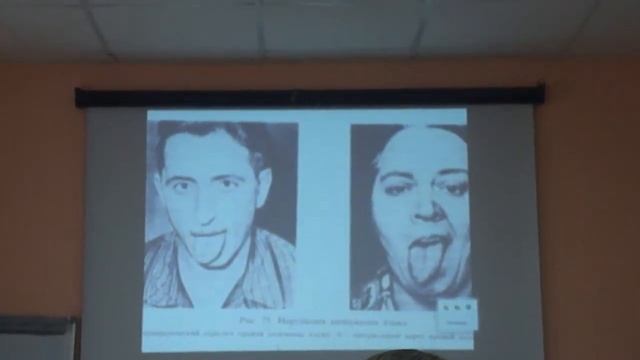 Дизартрия 4 смотреть онлайн